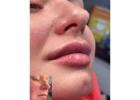 Best Service For Dermal Fillers in Grimsargh