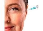 Best Anti-Wrinkle Treatments in Dartford