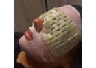 Best Service For Chemical Peels in Worsley